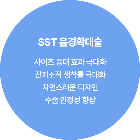 sst음경확대술